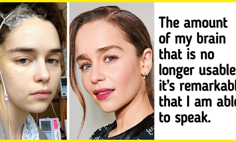 Emilia Clarke Honestly Shares Her Story About Losing a Part of Her Brain and Experiencing Awful Pain