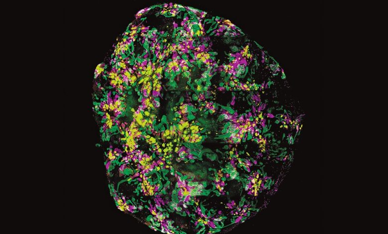 The Download: organoid uses, and open source voting machines