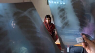 Most People With TB Report No Persistent Cough