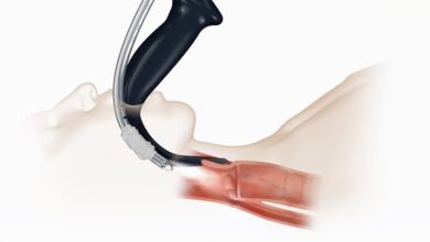 Use of Video Laryngoscopy Reduced Endotracheal Intubation Attempts