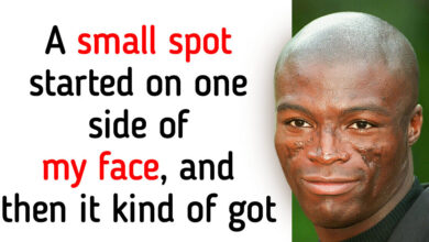 Seal Opens Up About «Traumatizing» Scars on His Face and What Caused Them
