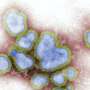 Study shows experts rate influenza as the number one pathogen of concern of pandemic potential
