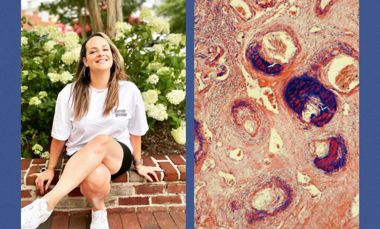 I Was Told I Had an STI. It Was Actually Cervical Cancer