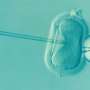 Time-lapse imaging for embryo selection in IVF does not improve the odds of live birth, large study finds