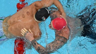 Benefits of Cupping: All About The Circular Marks Spotted on Olympians