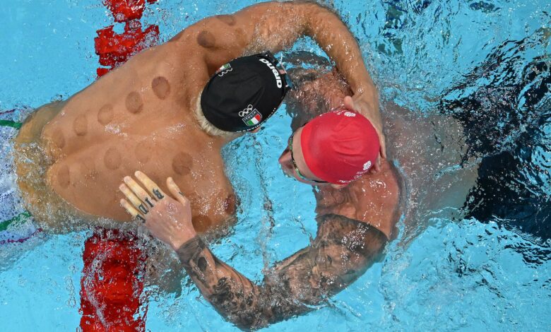 Benefits of Cupping: All About The Circular Marks Spotted on Olympians