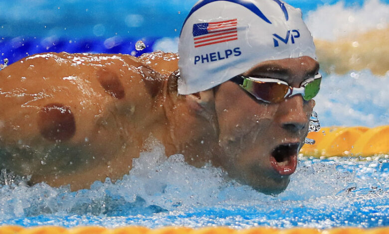 Explainer: Cupping Therapy & How the Olympics Spread the Word