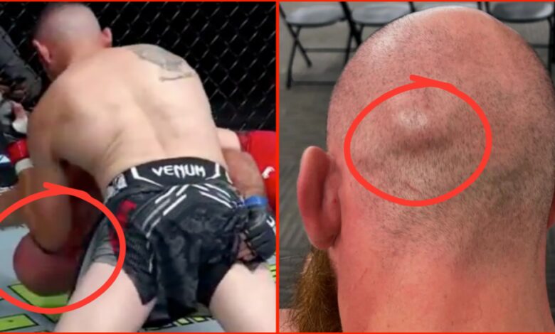 ‘This should be a no contest’… UFC fighter’s wife calls for first round KO loss to be overturned after ‘illegal elbow’