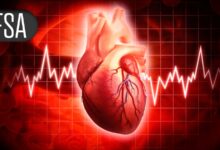 Metabolic Accelerator Shows Promise for Weight Loss Side of Obesity-HFpEF Equation