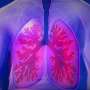 Understanding how deadly lung cancers control the local immune system