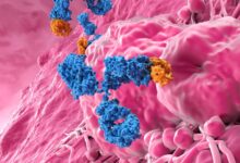 Precision Medicine Approach Shows Promise for Anaplastic Thyroid Cancer