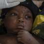 Mpox cases in Congo may be stabilizing. Experts say more vaccines are needed to stamp out virus