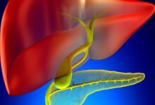 Primary Biliary Cholangitis Incidence and Prevalence Growing