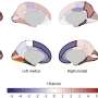 Does substance use change the brain’s structure, or does brain structure predispose some to substance use?