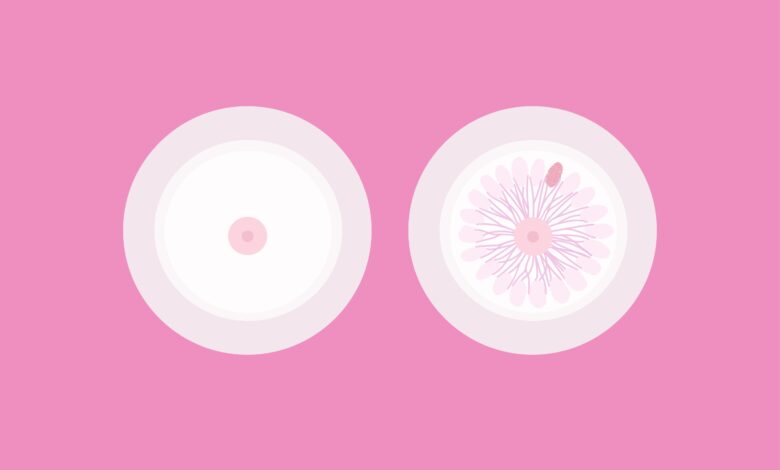 Does Breast Cancer Hurt? What You Need to Know About This Less Common Symptom