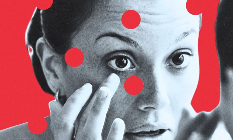 So You Lost Your Contact Lens in Your Eye. Here’s Exactly What to Do