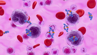 Early Rituximab Can Delay Need for Chemo in Follicular Lymphoma