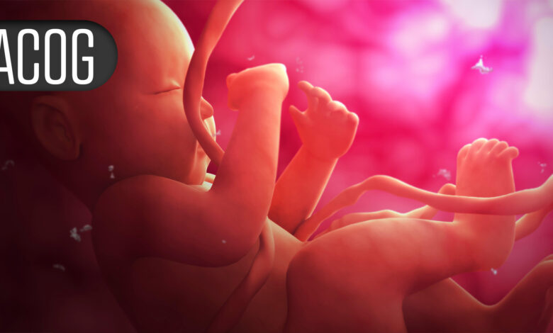 ACOG Calls for Pain Management for IUD Insertion, Other In-Office Procedures