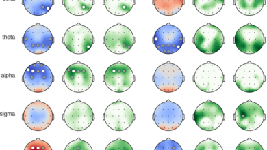 Caffeine induces age-dependent brain complexity and criticality during sleep