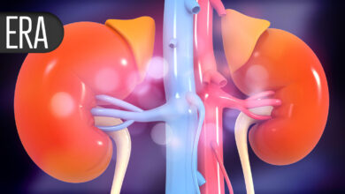 Novel Anticoagulant Flops for Staving Off Graft Thrombosis in Dialysis Patients