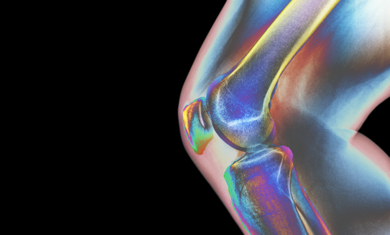 5 Things You Can Do Now to Prevent Osteoporosis in the Future