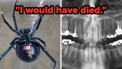 “A Little Voice Told Me To Be Careful” — People Are Sharing The Dumbest Ways They Almost Died, And Some Of These Are Terrifying But Some Are Hilarious