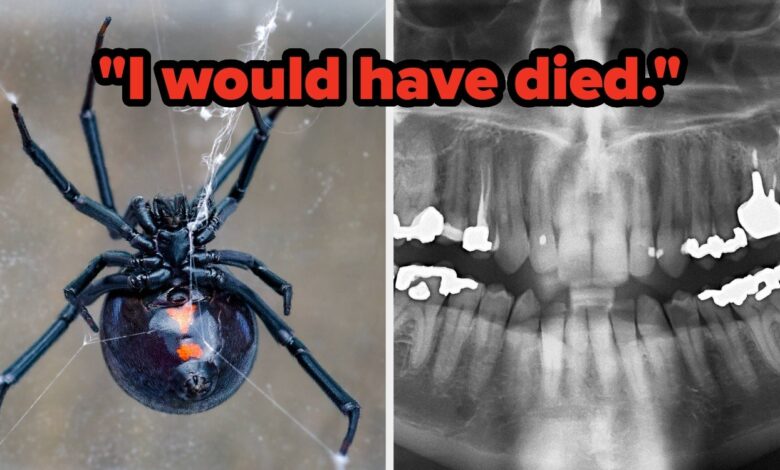 “A Little Voice Told Me To Be Careful” — People Are Sharing The Dumbest Ways They Almost Died, And Some Of These Are Terrifying But Some Are Hilarious