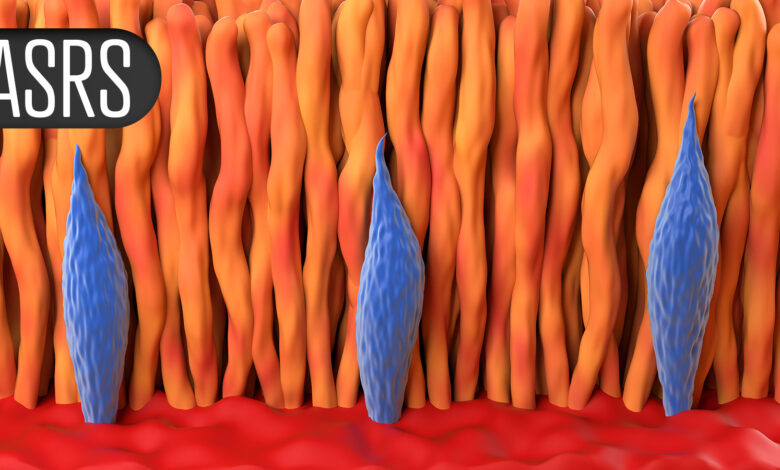 Combination Therapy for AMD Fails to Improve Vision Versus Single Drug