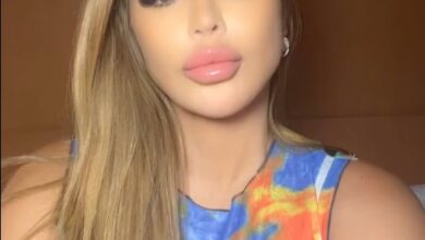 Larsa Pippen doubles down on allergic reaction claims after photo of ‘overfilled’ face went viral: ‘Keep on hating’