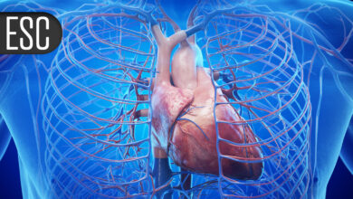 Vericiguat Gets Mixed Results in ‘Stable’ HFrEF