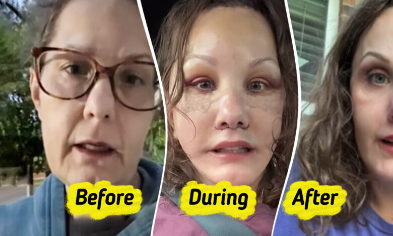 Woman, 50, Reveals Major Plastic Surgery Results That Make Her Look Decades Younger