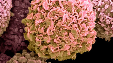 Trends in Global Cancer Cases, Deaths Offer Little Reassurance